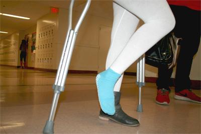 Crutches and a single shoe are a part of the daily routine for Tais. 